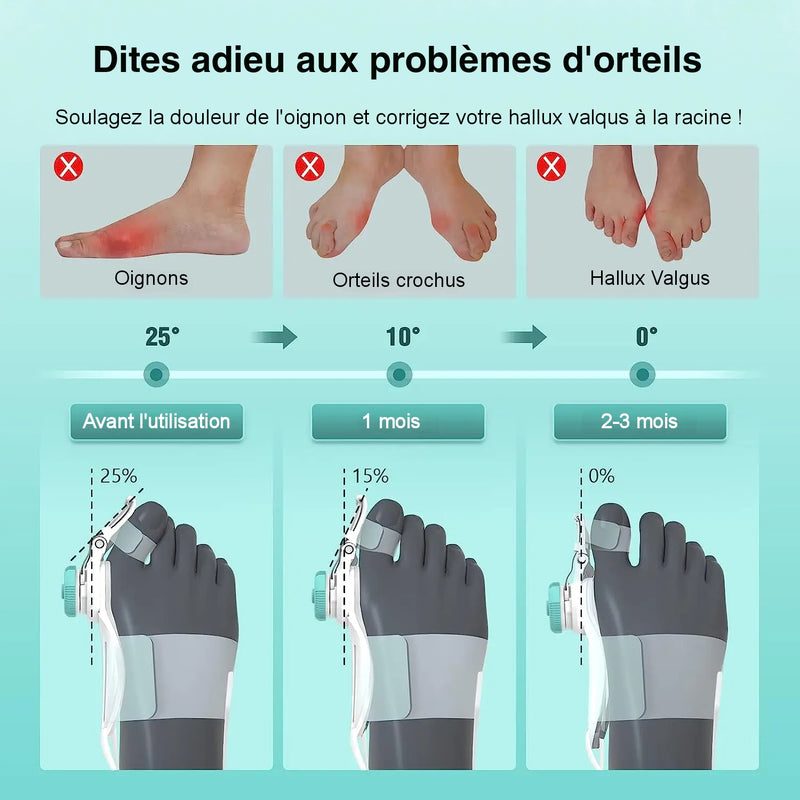 Correcteur universel pour hallux valgus